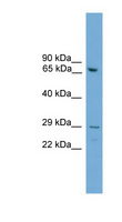 RGS18 Antibody - RGS18 antibody Western blot of Mouse Lung lysate. This image was taken for the unconjugated form of this product. Other forms have not been tested.