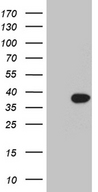 RGS18 Antibody - HEK293T cells were transfected with the pCMV6-ENTRY control. (Left lane) or pCMV6-ENTRY RGS18. (Right lane) cDNA for 48 hrs and lysed