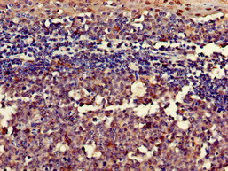 RGS18 Antibody - Immunohistochemistry of paraffin-embedded human tonsil tissue using RGS18 Antibody at dilution of 1:100