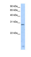 RGS18 Antibody - RGS18 antibody ARP42804_T100-NP_570138-RGS18(regulator of G-protein signalling 18) Antibody Western blot of Fetal Thymus lysate.  This image was taken for the unconjugated form of this product. Other forms have not been tested.