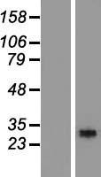 RGS18 Protein - Western validation with an anti-DDK antibody * L: Control HEK293 lysate R: Over-expression lysate