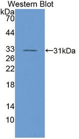 RGS19 Antibody - Western blot of RGS19 antibody.