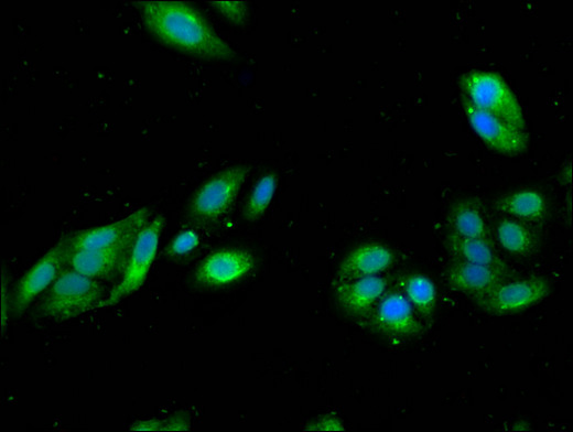 RGS19 Antibody - Immunofluorescent analysis of HepG2 cells using RGS19 Antibody at a dilution of 1:100 and Alexa Fluor 488-congugated AffiniPure Goat Anti-Rabbit IgG(H+L)