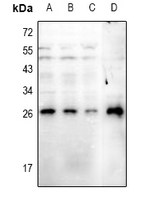 RGS19 Antibody - Western blot analysis of RGS19 (pS151) expression in A549 (A), H1792 (B), HepG2 (C), rat heart (D) whole cell lysates.