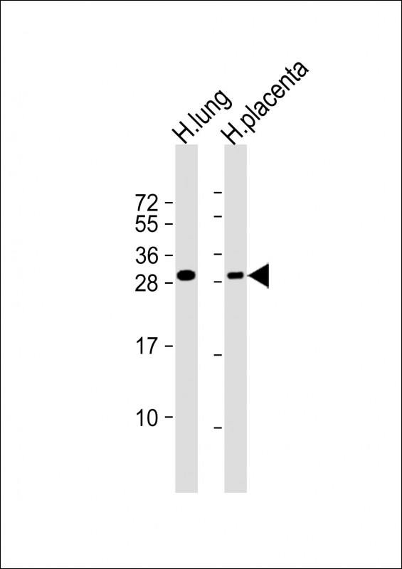 RGS19 Antibody - All lanes: Anti-RGS19 Antibody (S24) at 1:1000 dilution Lane 1: human lung lysate Lane 2: human placenta lysate Lysates/proteins at 20 µg per lane. Secondary Goat Anti-Rabbit IgG, (H+L), Peroxidase conjugated at 1/10000 dilution. Predicted band size: 25 kDa Blocking/Dilution buffer: 5% NFDM/TBST.