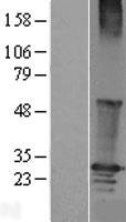 RGS19 Protein - Western validation with an anti-DDK antibody * L: Control HEK293 lysate R: Over-expression lysate