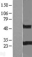 RGS19 Protein - Western validation with an anti-DDK antibody * L: Control HEK293 lysate R: Over-expression lysate