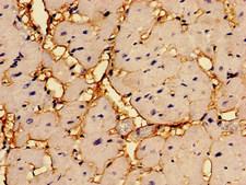 RGS2 Antibody - Immunohistochemistry of paraffin-embedded human heart tissue using RGS2 Antibody at dilution of 1:100