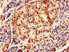 RGS2 Antibody - Immunohistochemistry of paraffin-embedded human pancreatic tissue using RGS2 Antibody at dilution of 1:100