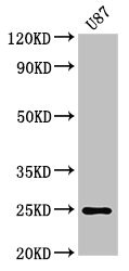 RGS2 Antibody - Western Blot Positive WB detected in: U87 whole cell lysate All lanes: RGS2 antibody at 3µg/ml Secondary Goat polyclonal to rabbit IgG at 1/50000 dilution Predicted band size: 25, 24, 2321 kDa Observed band size: 25 kDa