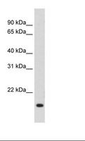 RGS2 Antibody - SP2/0 Cell Lysate.  This image was taken for the unconjugated form of this product. Other forms have not been tested.