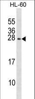 RGS2 Antibody - RGS2 Antibody western blot of HL-60 cell line lysates (35 ug/lane). The RGS2 antibody detected the RGS2 protein (arrow).