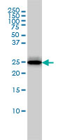 RGS2 Antibody - RGS2 monoclonal antibody (M01), clone 4C4 Western blot of RGS2 expression in MCF-7.