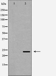 RGS2 Antibody - Western blot analysis of extracts of human brain tissue using RGS2 antibody. The lane on the left is treated with the antigen-specific peptide.