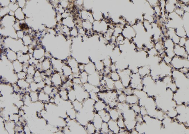 RGS2 Antibody - 1:100 staining mouse lung tissue by IHC-P. The sample was formaldehyde fixed and a heat mediated antigen retrieval step in citrate buffer was performed. The sample was then blocked and incubated with the antibody for 1.5 hours at 22°C. An HRP conjugated goat anti-rabbit antibody was used as the secondary.