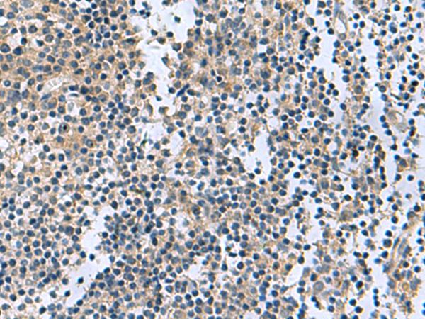 RGS2 Antibody - Immunohistochemistry of paraffin-embedded Human tonsil tissue  using RGS2 Polyclonal Antibody at dilution of 1:95(×200)