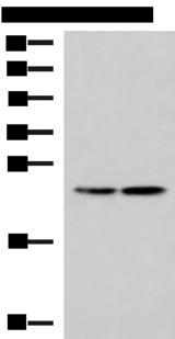 RGS2 Antibody - Western blot analysis of A549 and A172 cell lysates  using RGS2 Polyclonal Antibody at dilution of 1:1350