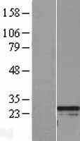 RGS2 Protein - Western validation with an anti-DDK antibody * L: Control HEK293 lysate R: Over-expression lysate