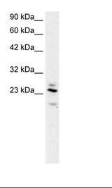 RGS20 / RGSZ1 Antibody - Fetal Brain Lysate.  This image was taken for the unconjugated form of this product. Other forms have not been tested.