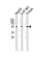 RGS20 / RGSZ1 Antibody - Western blot of lysates from HepG2, U-87 MG cell line and human brain tissue lysate (from left to right) with RGS20 Antibody. Antibody was diluted at 1:1000 at each lane. A goat anti-rabbit IgG H&L (HRP) at 1:5000 dilution was used as the secondary antibody. Lysates at 35 ug per lane.