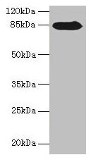 RGS20 / RGSZ1 Antibody - Western blot All lanes: NDST1 antibody at 6µg/ml + MCF-7 whole cell lysate Secondary Goat polyclonal to rabbit IgG at 1/10000 dilution Predicted band size: 101, 63 kDa Observed band size: 85 kDa