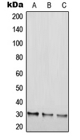 RGS20 / RGSZ1 Antibody - Western blot analysis of RGS20 expression in HEK293T (A); NIH3T3 (B); H9C2 (C) whole cell lysates.