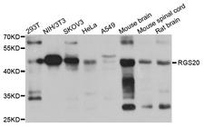 RGS20 / RGSZ1 Antibody - Western blot analysis of extract of various cells.