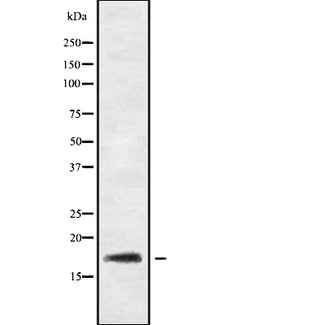 RGS21 Antibody - Western blot analysis of RGS21 using HeLa whole cells lysates