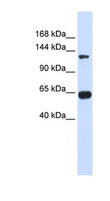 RGS22 Antibody - RGS22 antibody Western blot of Transfected 293T cell lysate. This image was taken for the unconjugated form of this product. Other forms have not been tested.