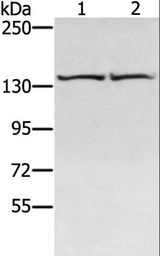 RGS22 Antibody - Western blot analysis of HeLa and hepg2 cell, using RGS22 Polyclonal Antibody at dilution of 1:400.
