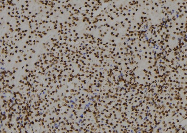 RGS22 Antibody - 1:100 staining mouse kidney tissue by IHC-P. The sample was formaldehyde fixed and a heat mediated antigen retrieval step in citrate buffer was performed. The sample was then blocked and incubated with the antibody for 1.5 hours at 22°C. An HRP conjugated goat anti-rabbit antibody was used as the secondary.