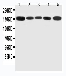 RGS3 Antibody - WB of RGS3 antibody. Lane 1: Rat Testis Tissue Lysate. Lane 2: Rat Brain Tissue Lysate. Lane 3: Rat Spleen Tissue Lysate. Lane 4: HELA Cell Lysate. Lane 5: U87 Cell Lysate.