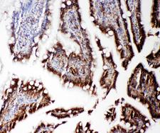 RGS3 Antibody - RGS3 antibody. IHC(P): Rat Intestine Tissue.
