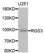 RGS3 Antibody - Western blot analysis of extracts of U251 cells.