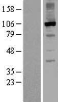 RGS3 Protein - Western validation with an anti-DDK antibody * L: Control HEK293 lysate R: Over-expression lysate