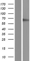 RGS3 Protein - Western validation with an anti-DDK antibody * L: Control HEK293 lysate R: Over-expression lysate