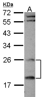 RGS4 Antibody - Sample (30 ug of whole cell lysate). A: Raji. 12% SDS PAGE. RGS4 antibody diluted at 1:1000.