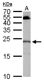 RGS4 Antibody - RGS4 antibody detects RGS4 protein by Western blot analysis. A. 50 ug mouse cerebellum lysate/extract. 12 % SDS-PAGE. RGS4 antibody dilution:1:1000