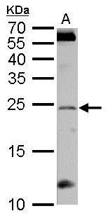 RGS4 Antibody - RGS4 antibody detects RGS4 protein by Western blot analysis. A. 50 ug rat brain lysate/extract. 12 % SDS-PAGE. RGS4 antibody dilution:1:1000