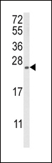 RGS4 Antibody - Western blot of RGS4 Antibody in MDA-MB231 cell line lysates (35 ug/lane). RGS4 (arrow) was detected using the purified antibody.