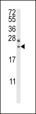 RGS4 Antibody - Western blot of RGS4 Antibody in mouse brain tissue lysates (35 ug/lane). RGS4 (arrow) was detected using the purified antibody.