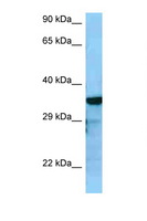 RGS4 Antibody - RGS4 antibody Western blot of HepG2 Cell lysate. Antibody concentration 1 ug/ml.  This image was taken for the unconjugated form of this product. Other forms have not been tested.