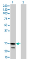 RGS4 Antibody - Western Blot analysis of RGS4 expression in transfected 293T cell line by RGS4 monoclonal antibody (M01), clone 2B2.Lane 1: RGS4 transfected lysate(23.3 KDa).Lane 2: Non-transfected lysate.