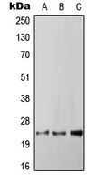 RGS4 Antibody - Western blot analysis of RGS4 expression in HepG2 (A); SP2/0 (B); PC12 (C) whole cell lysates.