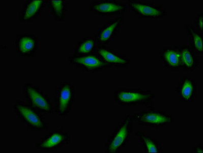 RGS4 Antibody - Immunofluorescent analysis of Hela cells using RGS4 Antibody at dilution of 1:100 and Alexa Fluor 488-congugated AffiniPure Goat Anti-Rabbit IgG(H+L)