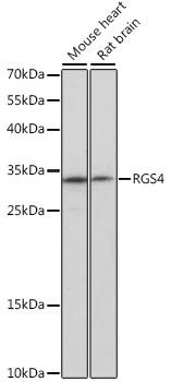 RGS4 Antibody - Western blot analysis of extracts of various cell lines using RGS4 Polyclonal Antibody at dilution of 1:1000.