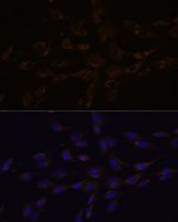 RGS4 Antibody - Immunofluorescence analysis of C6 cells using RGS4 Polyclonal Antibody at dilution of 1:100.Blue: DAPI for nuclear staining.