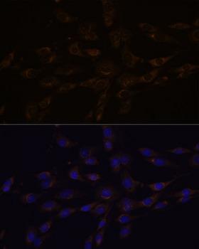 RGS4 Antibody - Immunofluorescence analysis of C6 cells using RGS4 Polyclonal Antibody at dilution of 1:100.Blue: DAPI for nuclear staining.