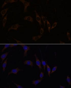RGS4 Antibody - Immunofluorescence analysis of L929 cells using RGS4 Polyclonal Antibody at dilution of 1:100.Blue: DAPI for nuclear staining.
