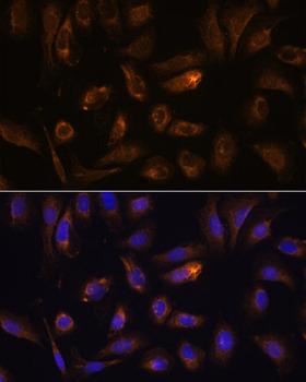 RGS4 Antibody - Immunofluorescence analysis of U-2OS cells using RGS4 Polyclonal Antibody at dilution of 1:100.Blue: DAPI for nuclear staining.